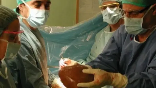 Aragón alcanza cifras récord en donantes de órganos