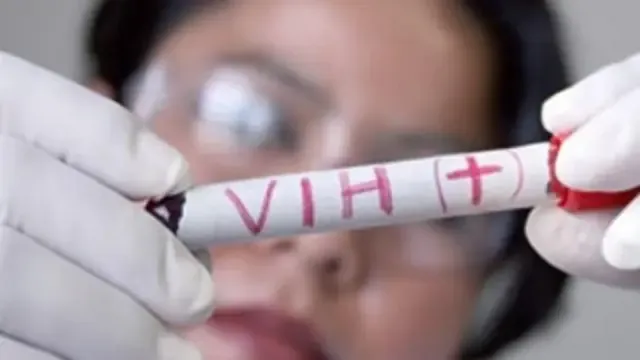 Confirmada la segunda curación en el mundo de un paciente con VIH