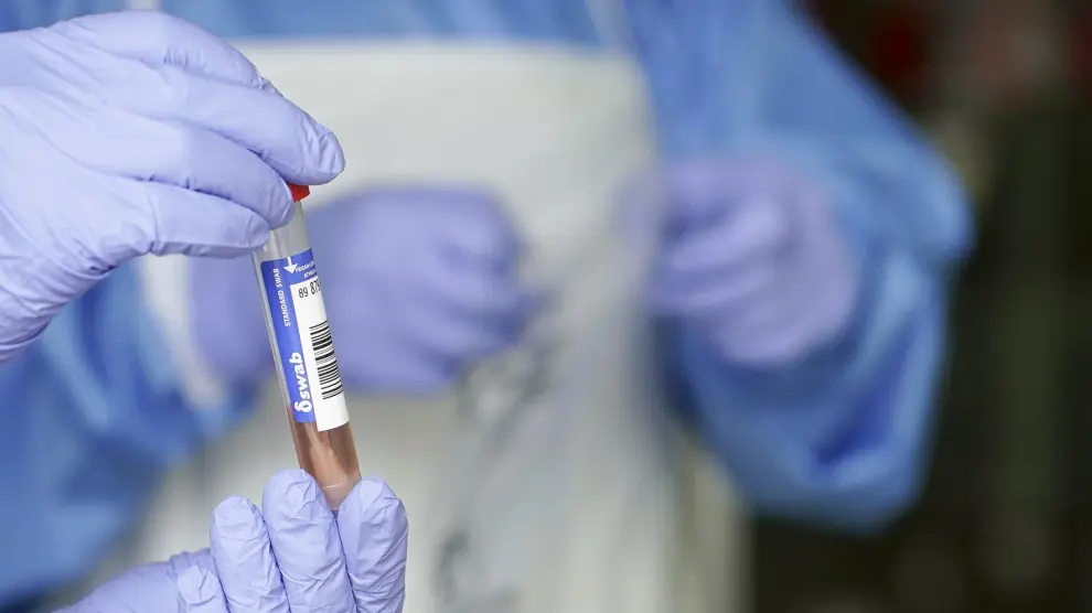 Sanidad da a las CCAA el control de los test en laboratorios privados