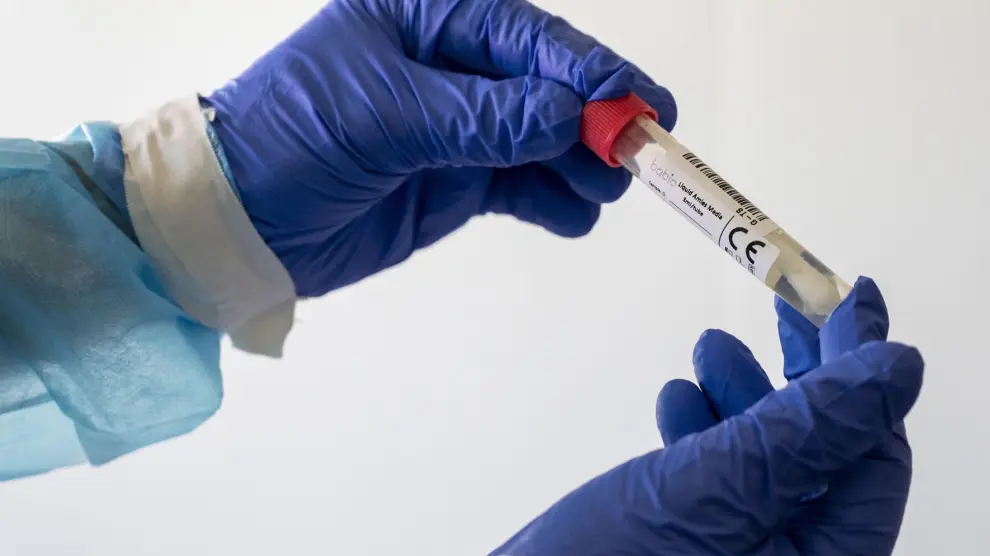 El PP ve "alarmante" la situación y reclama test de coronavirus masivos a la población