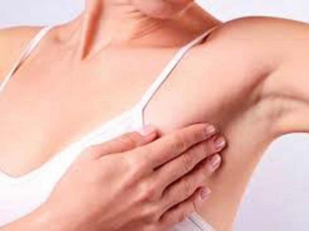 El Instituto Vall d'Hebron detecta una proteína para evitar la metástasis del cáncer de mama