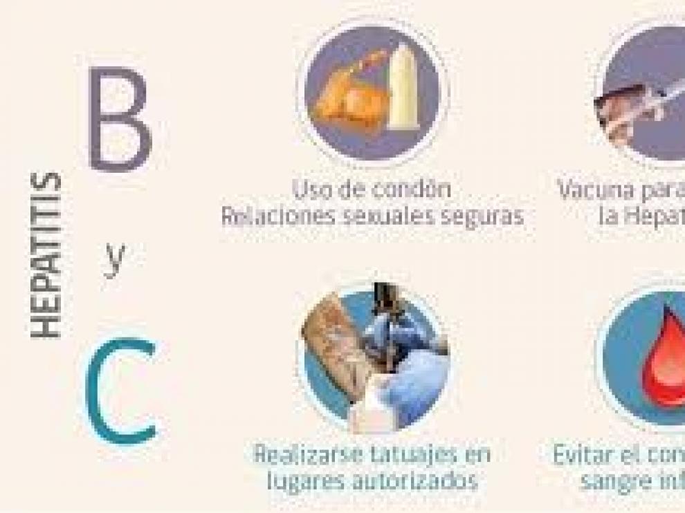 La incidencia de la hepatitis A bajó un 21 % en Aragón en 2018