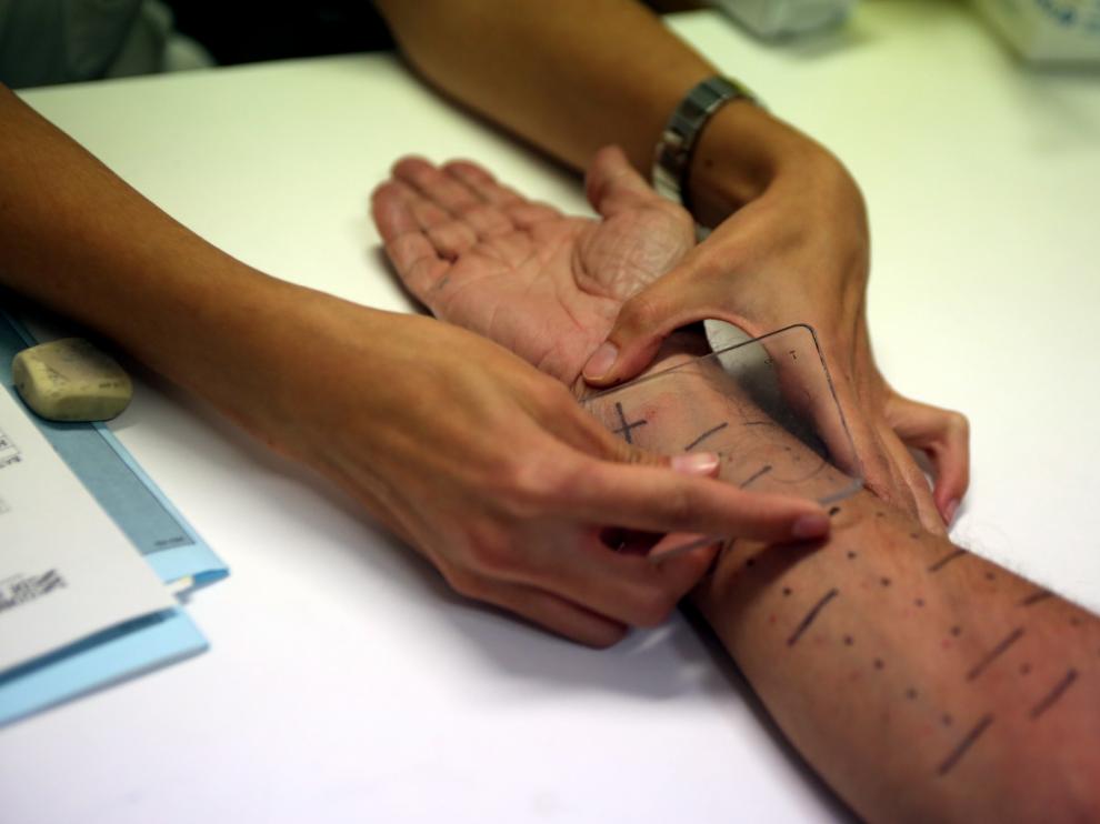 El Servicio de Alergología del Hospital San Jorge de Huesca atiende casi dos mil consultas