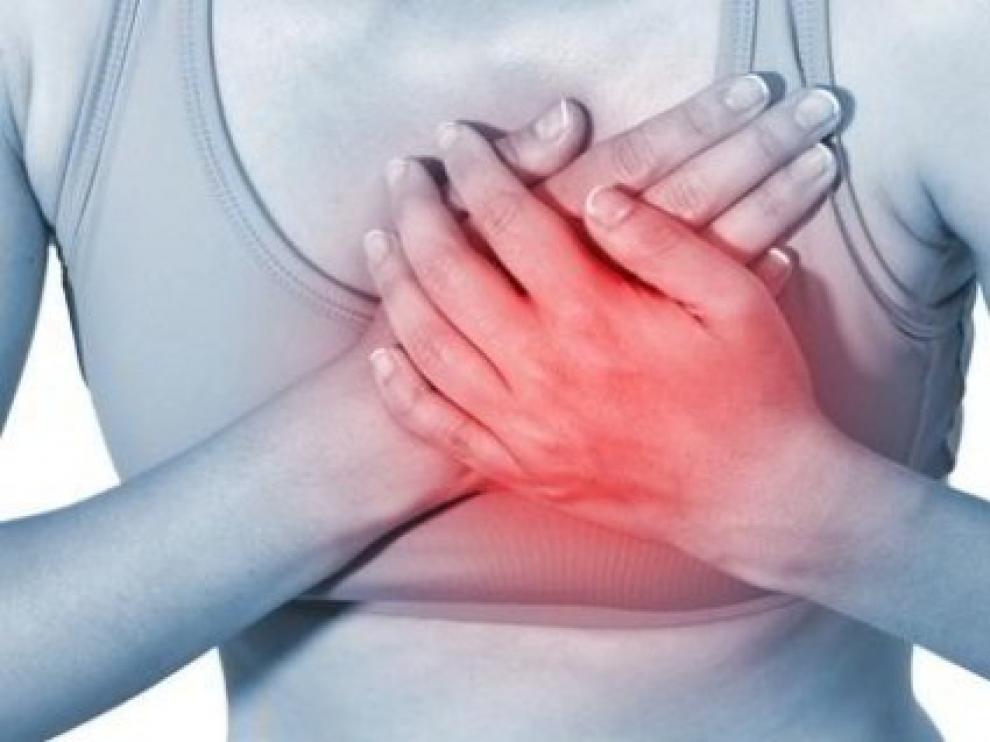 Hombres y mujeres pueden presentar síntomas distintos en caso de infarto