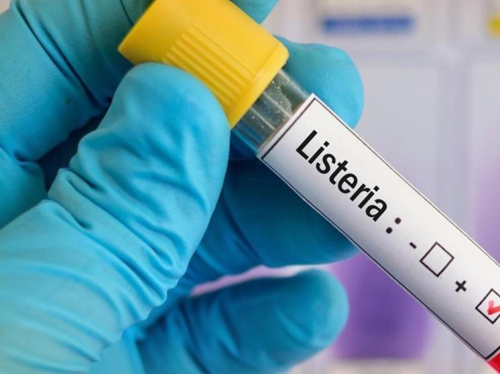 Sanidad señala 11 casos con posible relación al brote de listeriosis en Aragón