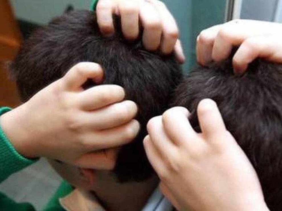 Qué hacer cuando pican los piojos en la vuelta al cole