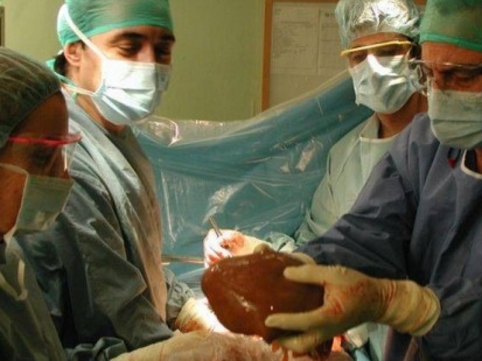 Aragón alcanza cifras récord en donantes de órganos