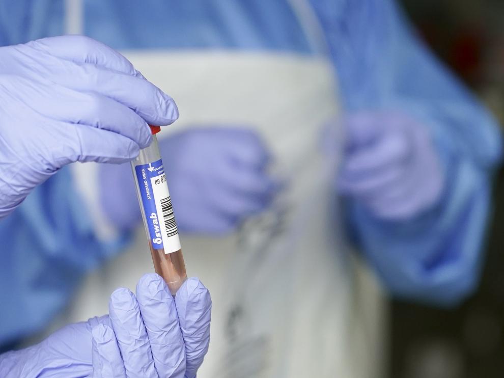 Sanidad da a las CCAA el control de los test en laboratorios privados