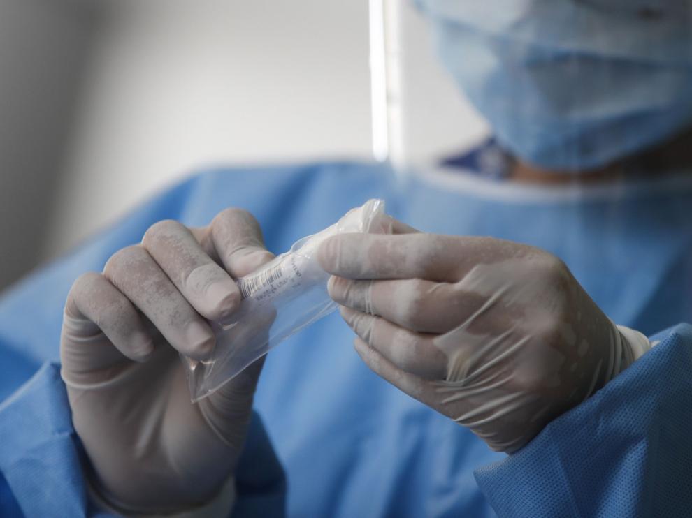 La pérdida del olfato por coronavirus varias hipótesis y aún pocas certezas