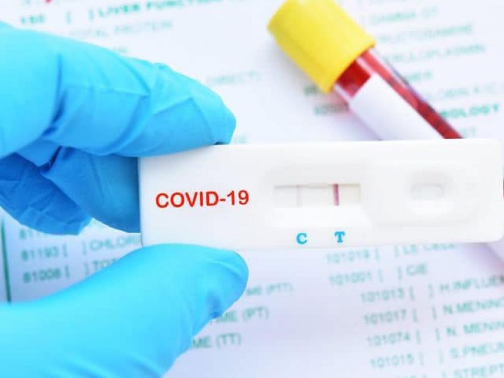 Piden en Monzón que les permitan hacer test de coronavirus masivos