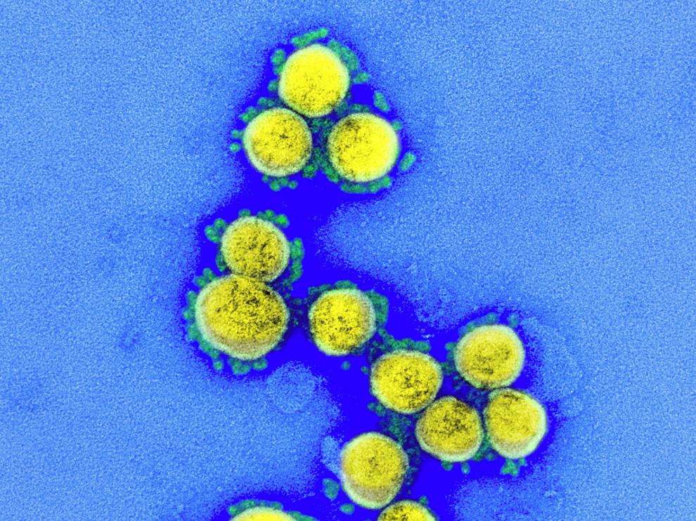 La dimensión ecológica de las enfermedades infecciosas