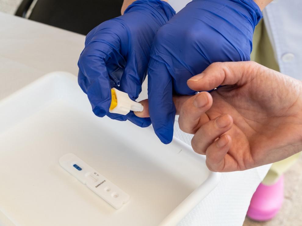 Alcaldes del PP piden que se les deje hacer test para detectar el coronavirus