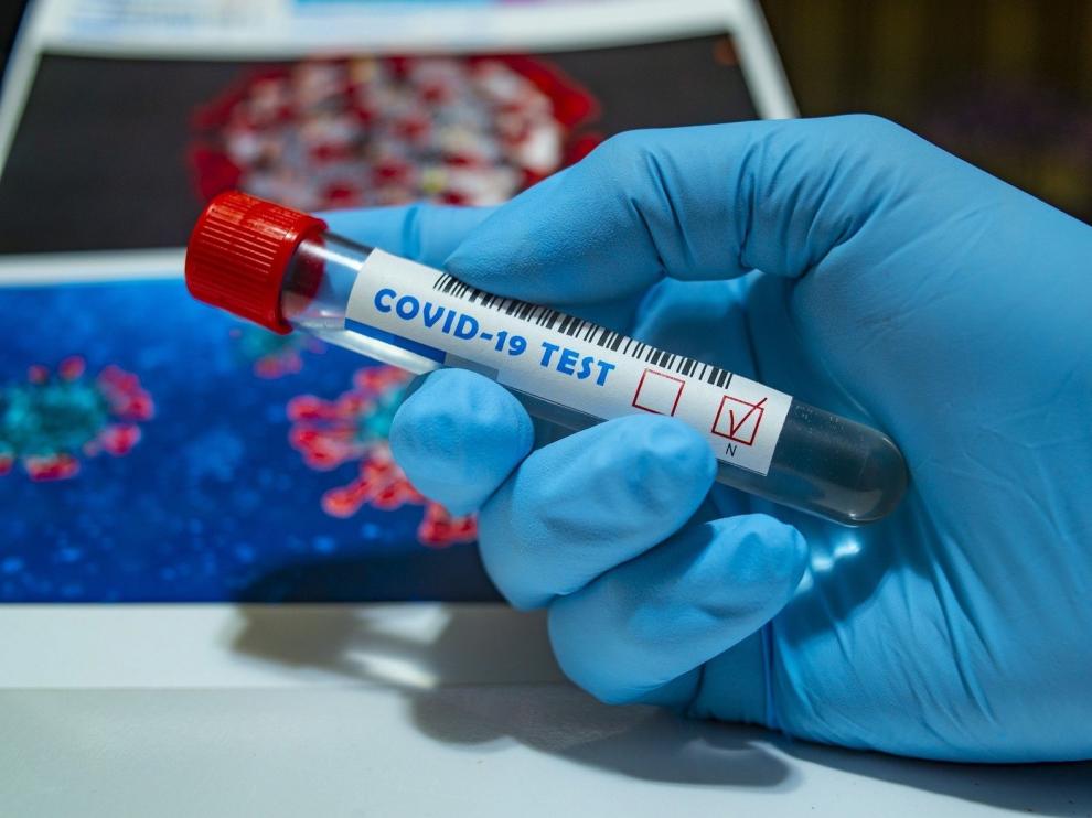 CEOE Aragón lanza una iniciativa para hacer test en las empresas
