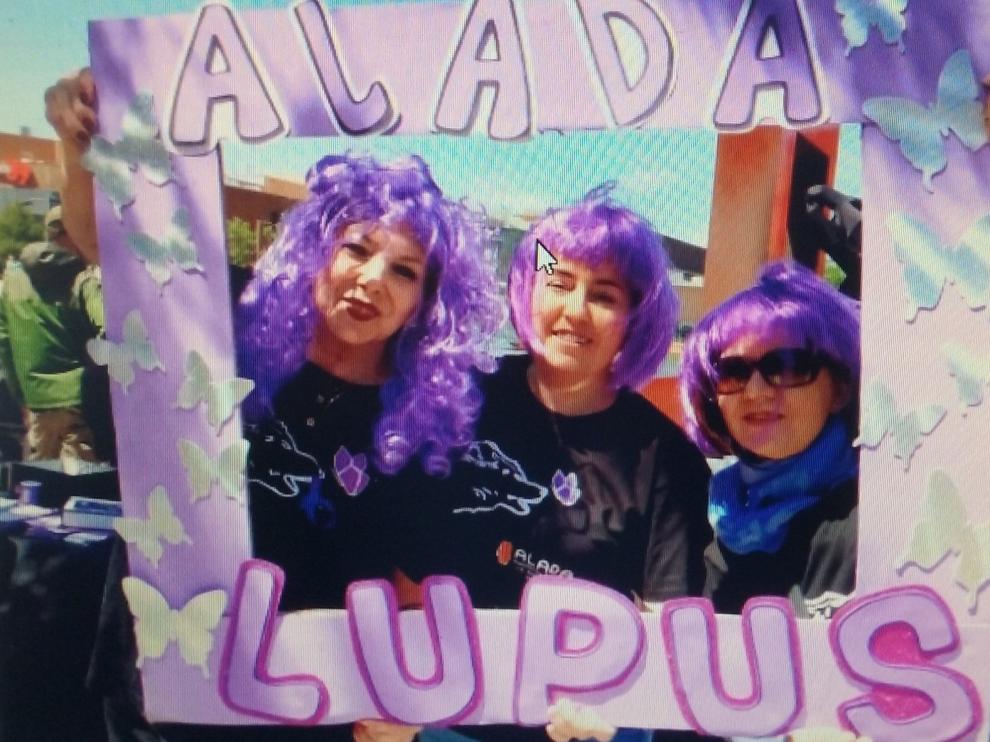 Pacientes de lupus sufren "cierta exclusión familiar, social y laboral"