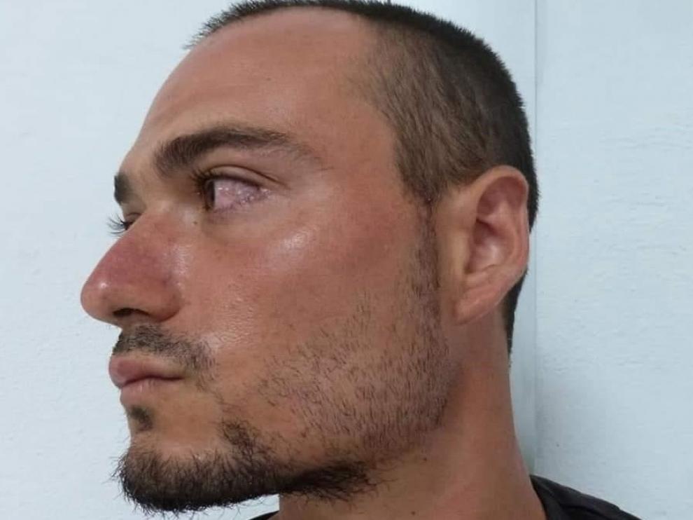 El 'Rambo de Requena' sigue ingresado en el Hospital Miguel Servet de Zaragoza