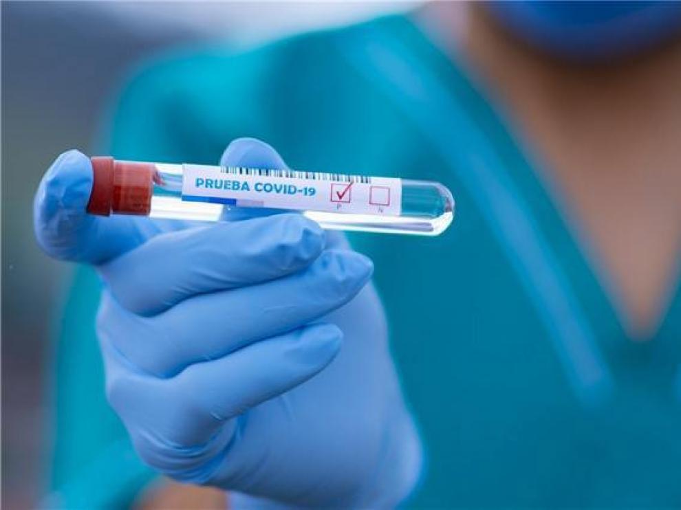 La provincia de Huesca suma 70 nuevos casos de coronavirus, 26 de ellos en la capital