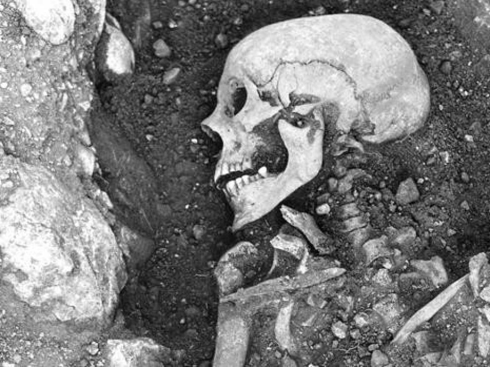 Los vikingos padecían viruela y pudieron haber ayudado a propagar el virus más mortal del mundo