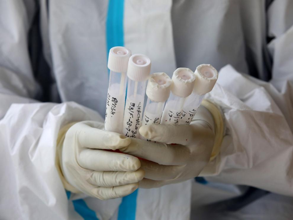 Investigadores del CSIC prueban fármacos usados contra el cáncer para frenar la covid-19