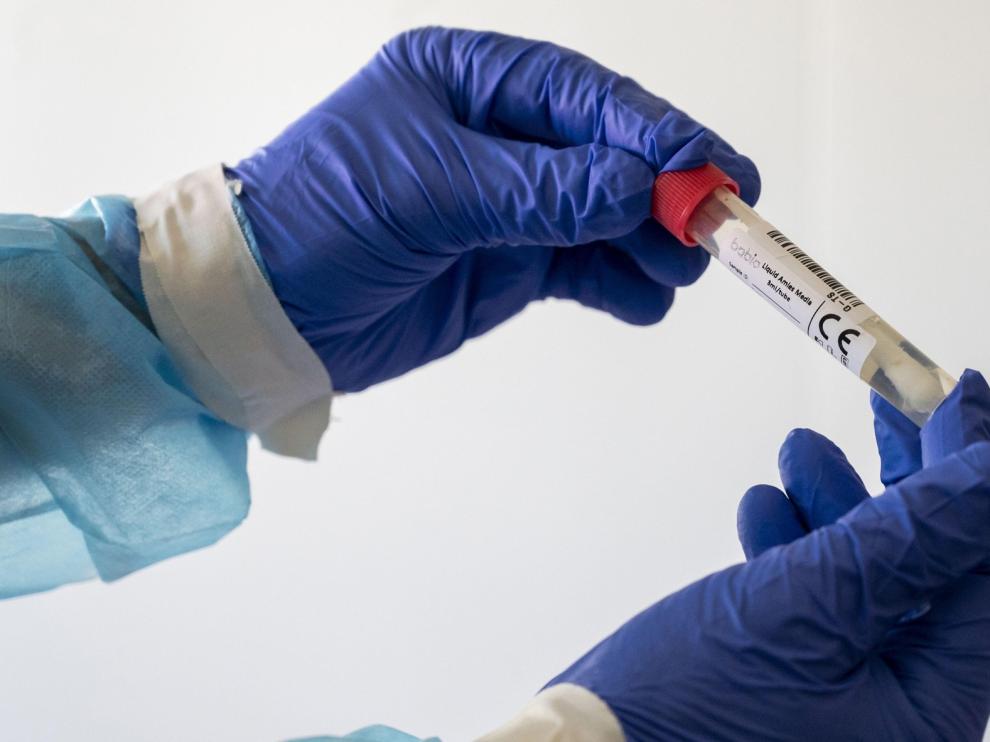 El PP ve "alarmante" la situación y reclama test de coronavirus masivos a la población