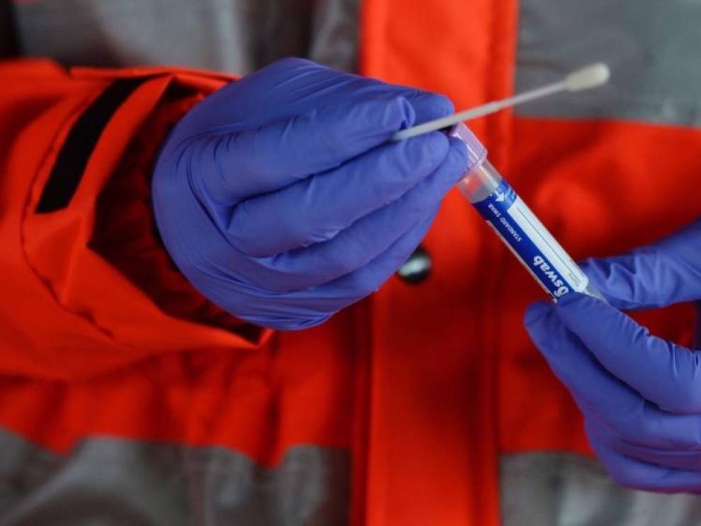 La detección temprana permite frenar oleadas, según la Universidad de Zaragoza