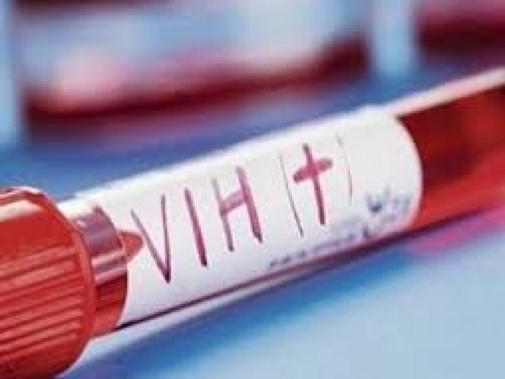 El VIH infectó en 2019 a un menor de 20 años cada 100 segundos