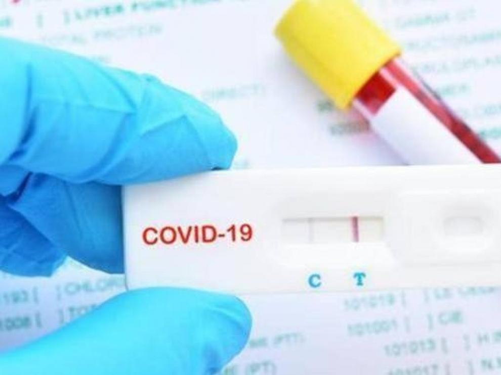 La OMC advierte de que los test en farmacias no son fiables