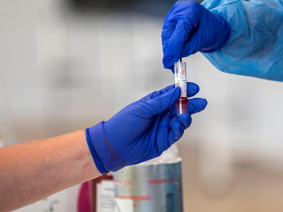 Aragón ha realizado 645.736 pruebas diagnósticas de covid desde el inicio de la epidemia