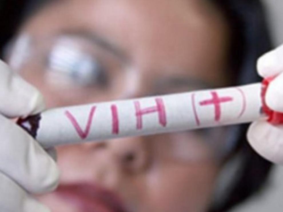 El objetivo de erradicar el VIH en el año 2030 parece inalcanzable