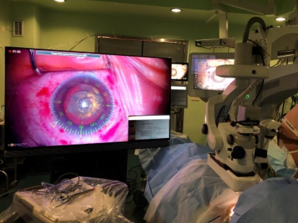 Imagen de una intervención de cataratas en el Clínico con la nueva tecnología.