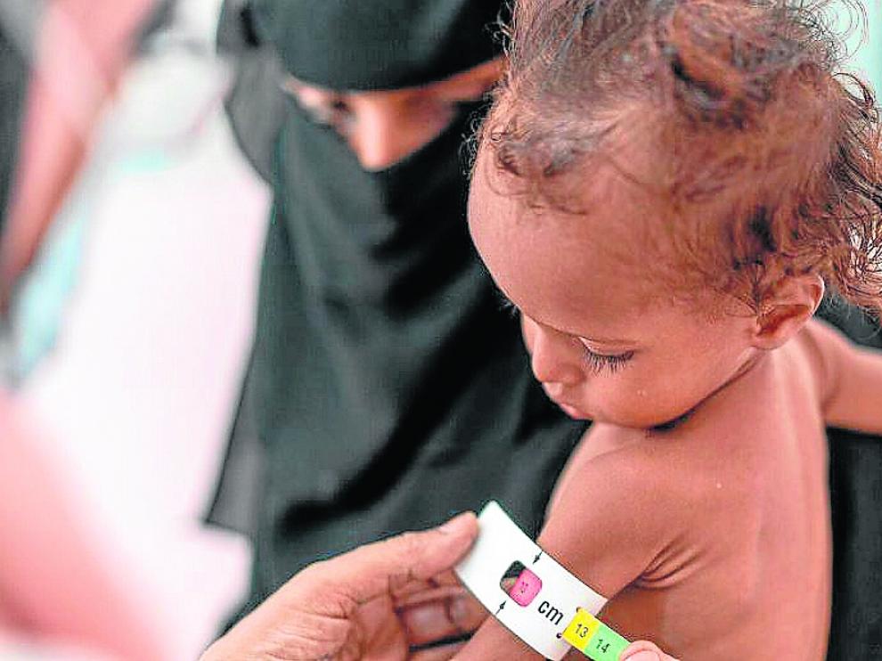 En Yemen la situación empieza a ser preocupante.