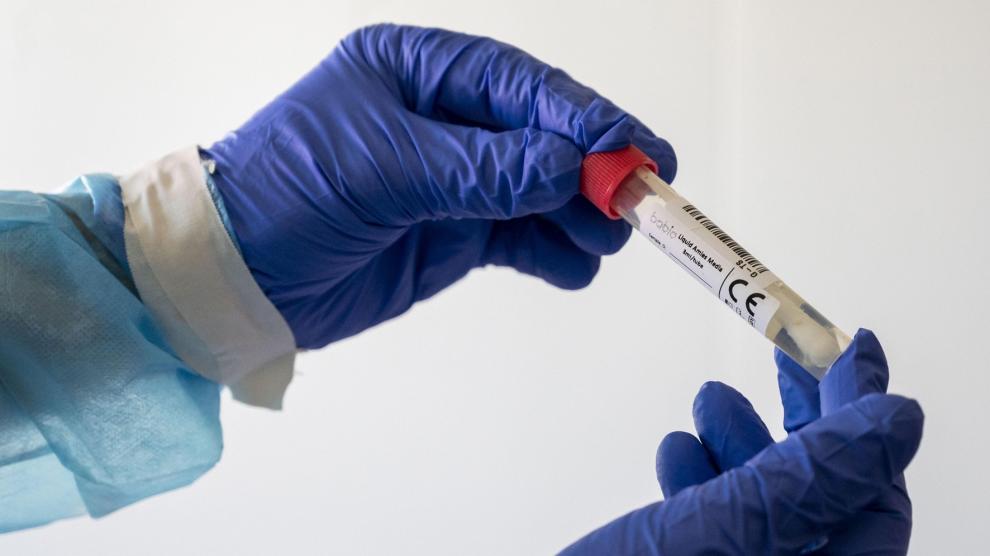 El PP ve "alarmante" la situación y reclama test de coronavirus masivos a la población